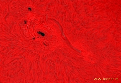 Sonnenfleck 1164 und Filament am 5. März 2011